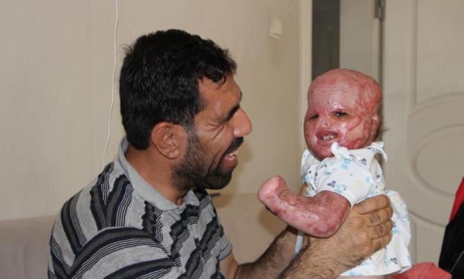 ‘YÜZDE 90 YAŞAMAZ’ DENİLEN DELAL BEBEK, ŞİMDİ ANNESİNİ BEKLİYOR